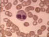 eosinophil.jpg (519675 bytes)