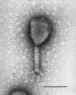 bactphage-bw.jpg (77888 bytes)